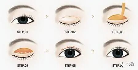 双眼皮|说出来你可能不信，wink能让眼睛变大