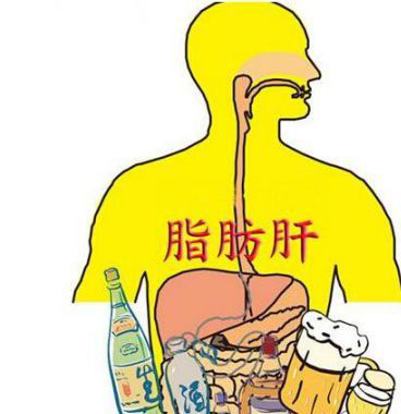 脂肪肝|脂肪肝是如何导致的