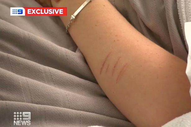 西澳大利亚|澳洲一女子遭30吨重座头鲸撞击，事发前另有潜水员在相同地点遇袭