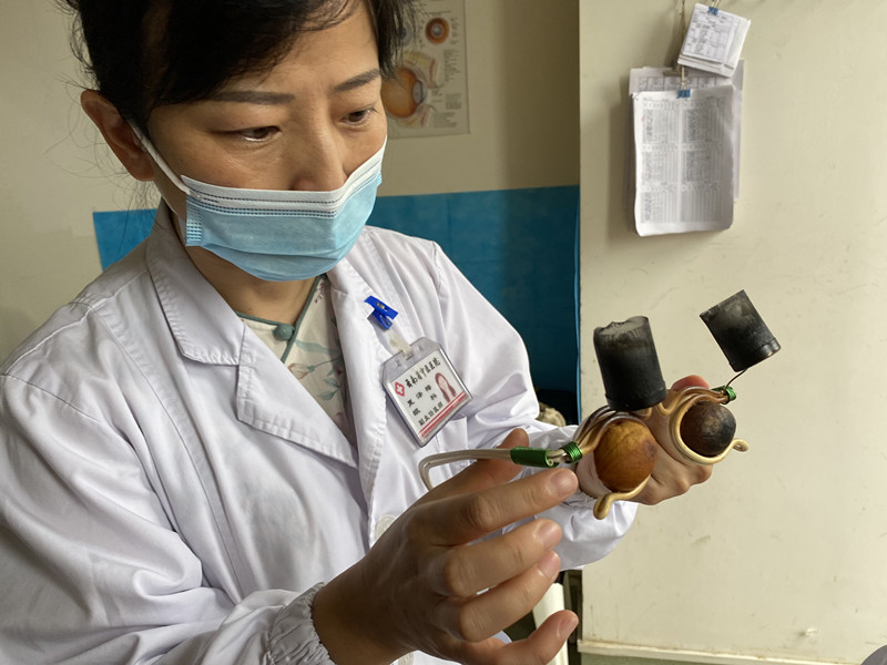 用核桃做隔物灸10岁男孩的100度真性近视恢复正常水平