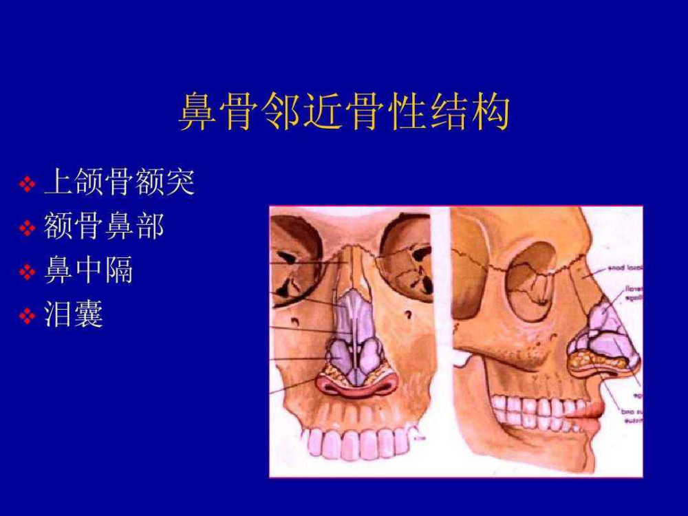 鼻骨骨折的治疗 腾讯新闻