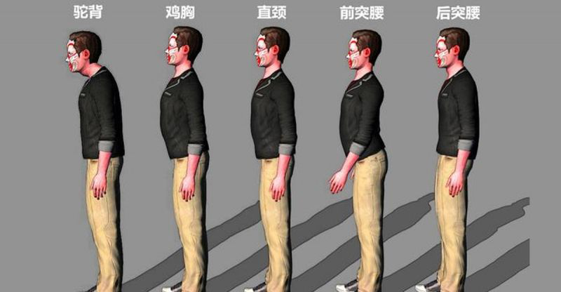 鸡胸|鸡胸的治疗与预防