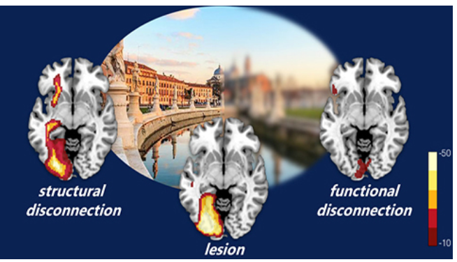 神经退行性疾病|【脑科学顶刊导读52期】运动皮层微环路对神经退行性疾病的启发