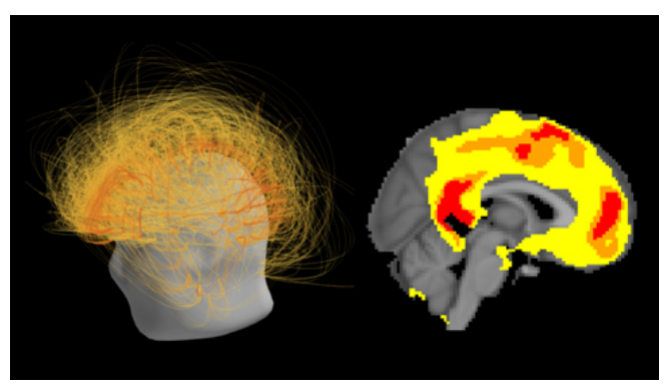 神经退行性疾病|【脑科学顶刊导读52期】运动皮层微环路对神经退行性疾病的启发