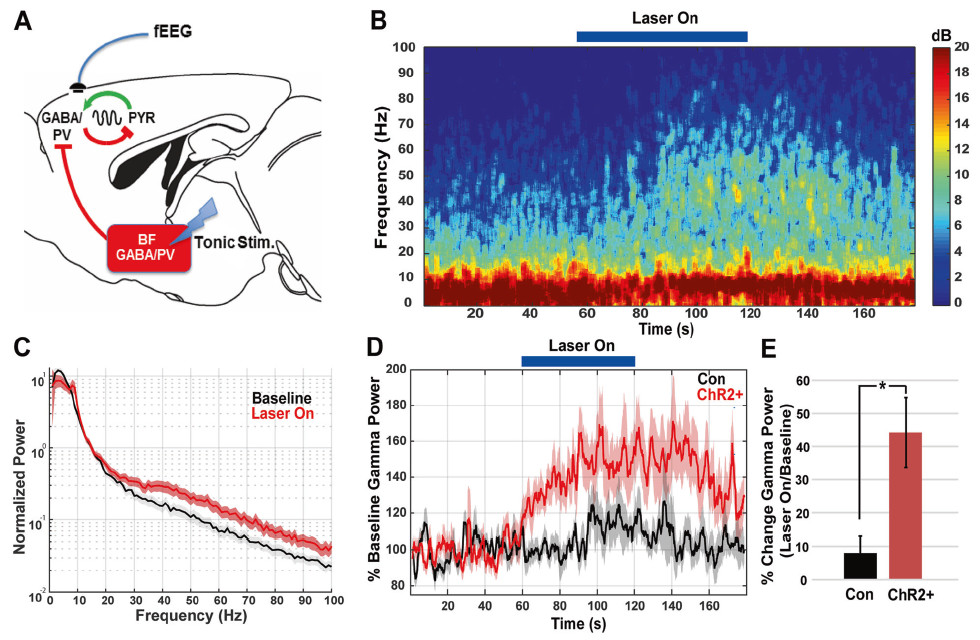 神经退行性疾病|【脑科学顶刊导读52期】运动皮层微环路对神经退行性疾病的启发