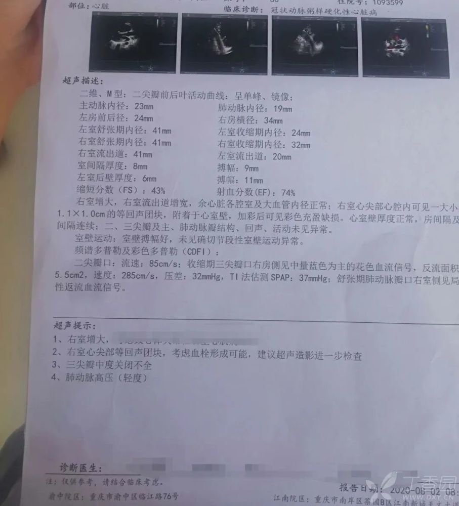 你对这个病历咋看?有什么诊断建议和治疗策略? 图片来源:作者提供