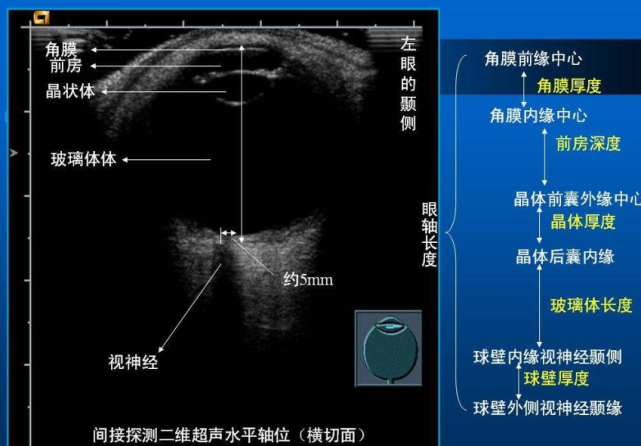 初心学眼部超声笔记