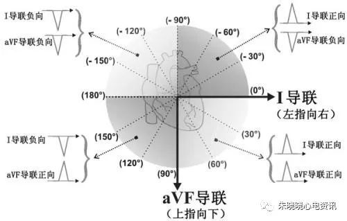 心电轴不偏 腾讯网
