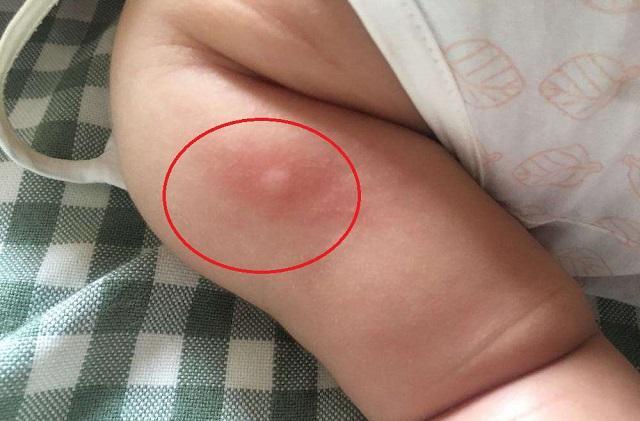 蚊子|蚊子的危害可致命！家有“招蚊宝宝”，试试这些驱蚊方法，很有效