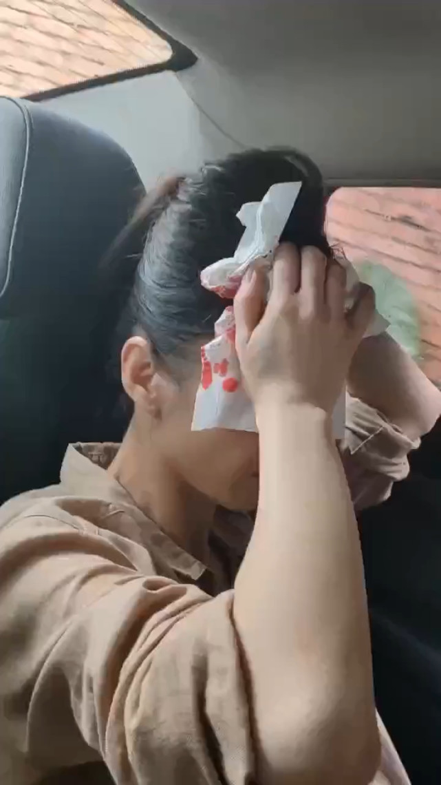 一线|黄圣依被道具砸伤头部流血,团队:姐姐已去医院,在等消息