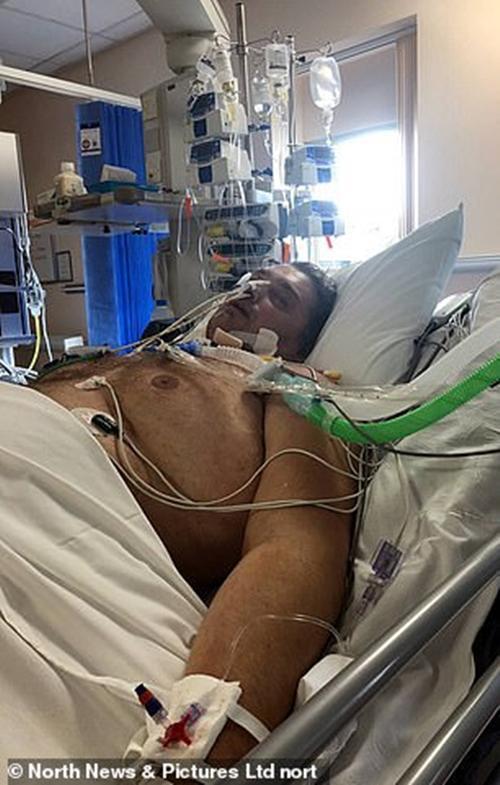 车祸|英男子遭遇严重车祸差点没命，住院感染新冠，20个月后终于出院