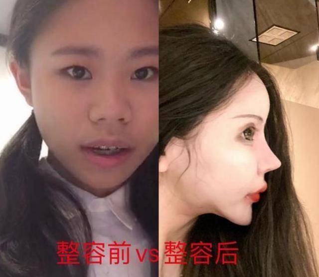 整容|整容70多次的女网红微博发声明：我要去参加选秀节目了