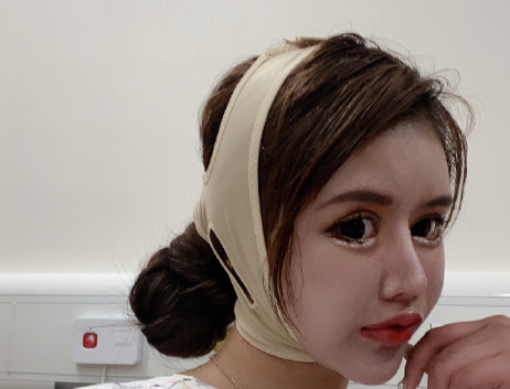 整容|整容70多次的女网红微博发声明：我要去参加选秀节目了