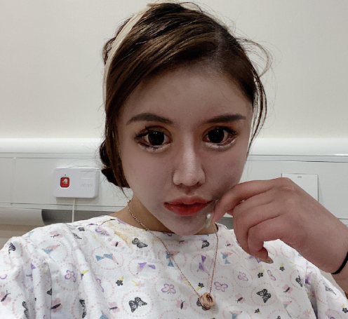 整容|整容70多次的女网红微博发声明：我要去参加选秀节目了