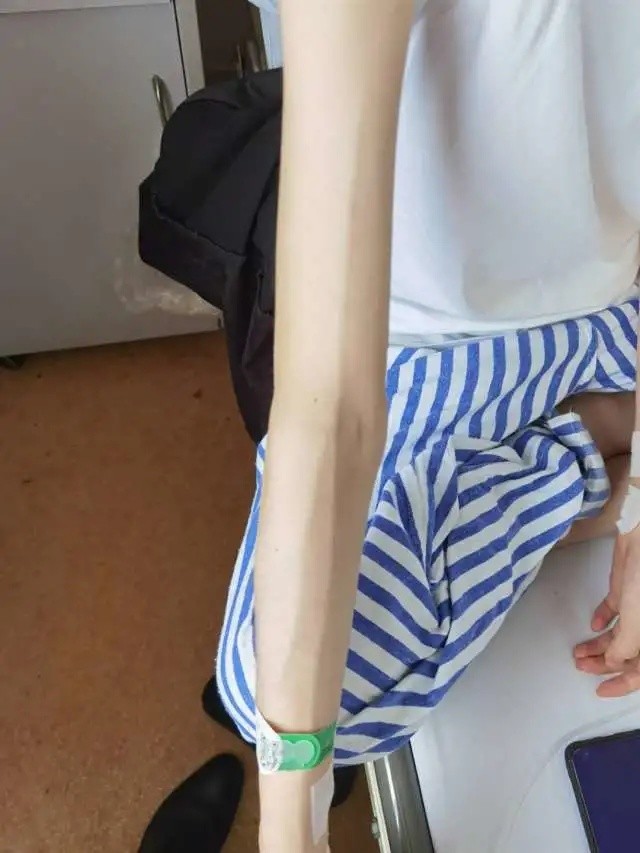 杭州女孩青春期暴瘦40斤看到她手指医生一下明白了再这样会要你的命