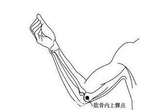 网球肘,矿工肘,高尔夫球肘,你了解多少,如何更好的治疗呢_腾讯新闻