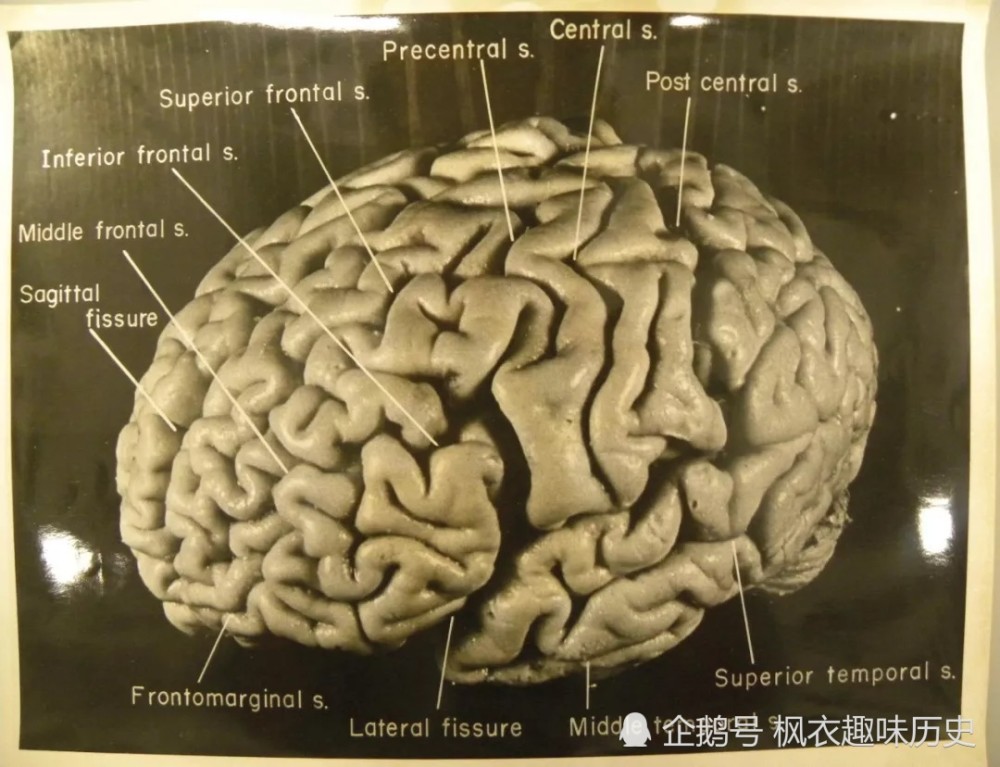 爱因斯坦死后他的脑子到哪里去了