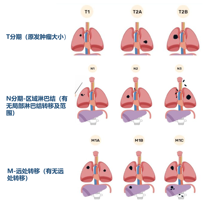 肺癌为什么需要基因检测?