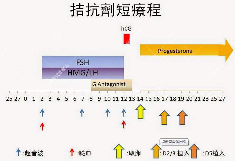 试管微刺激好还是拮抗剂好(试管婴儿微刺激方案和拮抗剂方案对比)-第2张图片-鲸幼网