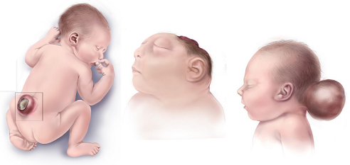 黑人会被晒黑吗?