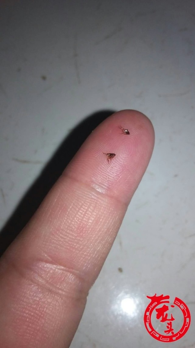 哈市平房区花园小区跳蚤作妖有居民一天被咬30多个包