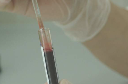 皮肤癌|新研究揭示了皮肤癌如何开始