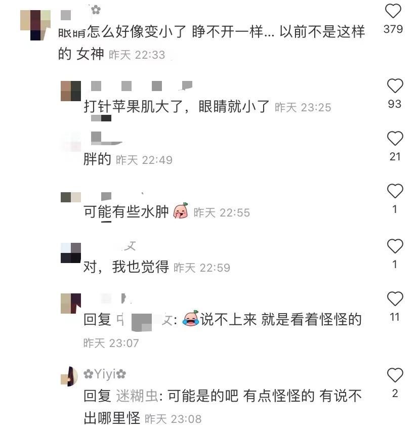 大s|打针后遗症？大S录视频被指脸部僵硬浮肿，眼睛始终睁不开