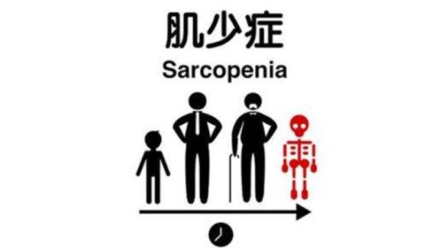 肌少症又称"肌肉减少症",近期亚洲肌少症工作组(awgs)对肌少症的定义