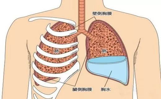 呼吸困難與患者胸廓順應性下降,肺容量下降刺激神經反射有關.