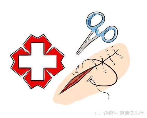 急诊面部浅表伤口美容缝合的效果分析