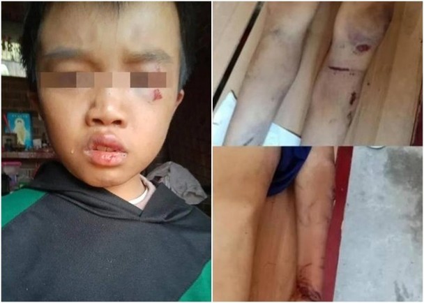 镇江一位虎爸暴打儿子不是个案而是社会问题应该引起足够重视