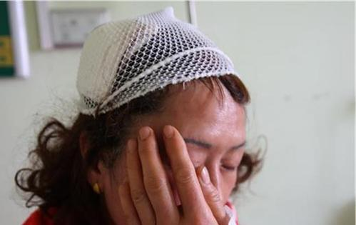 头皮损伤有什么特效药