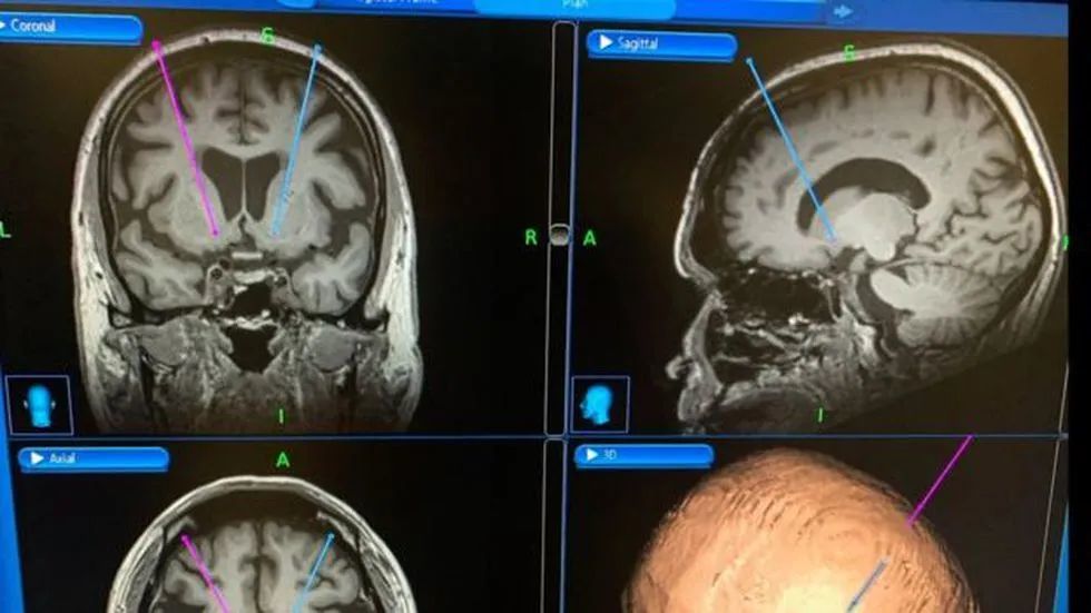 微生物实验室|新冠肺炎与科学家暴死：是否隐藏着不为人知的秘密