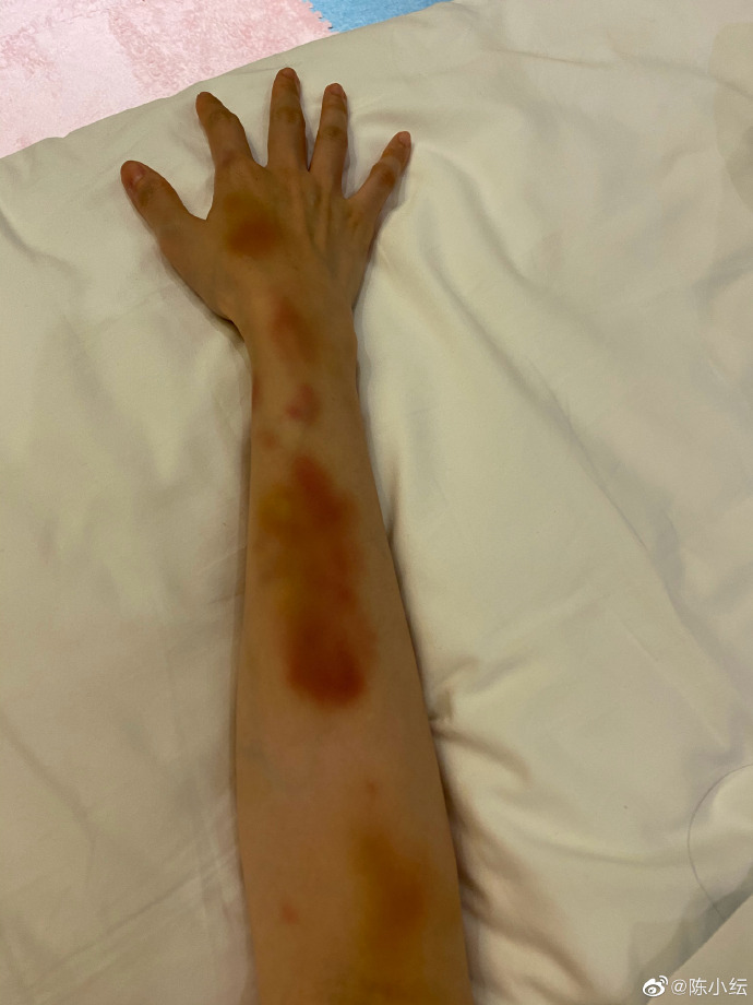 张艺凡|张艺凡祝贺陈小纭获体操冠军，并晒两人合影，脸小的优势很明显