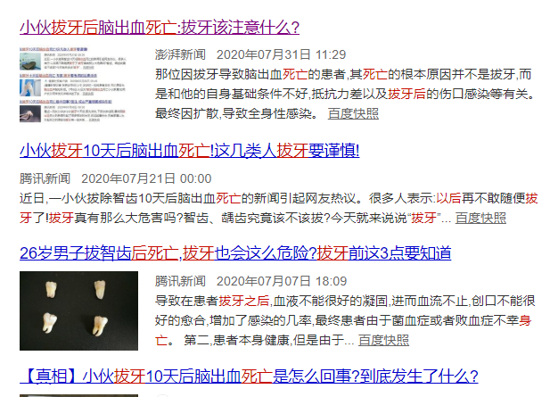 这些人要慎重拔牙|拔牙|脑出血|智齿|蛀牙|冠周炎|牙齿