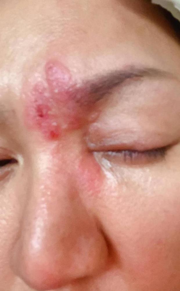 脸生蛇险毁容 香港女歌手称备受折磨 嫁入豪门遭背叛今选择复出 腾讯新闻