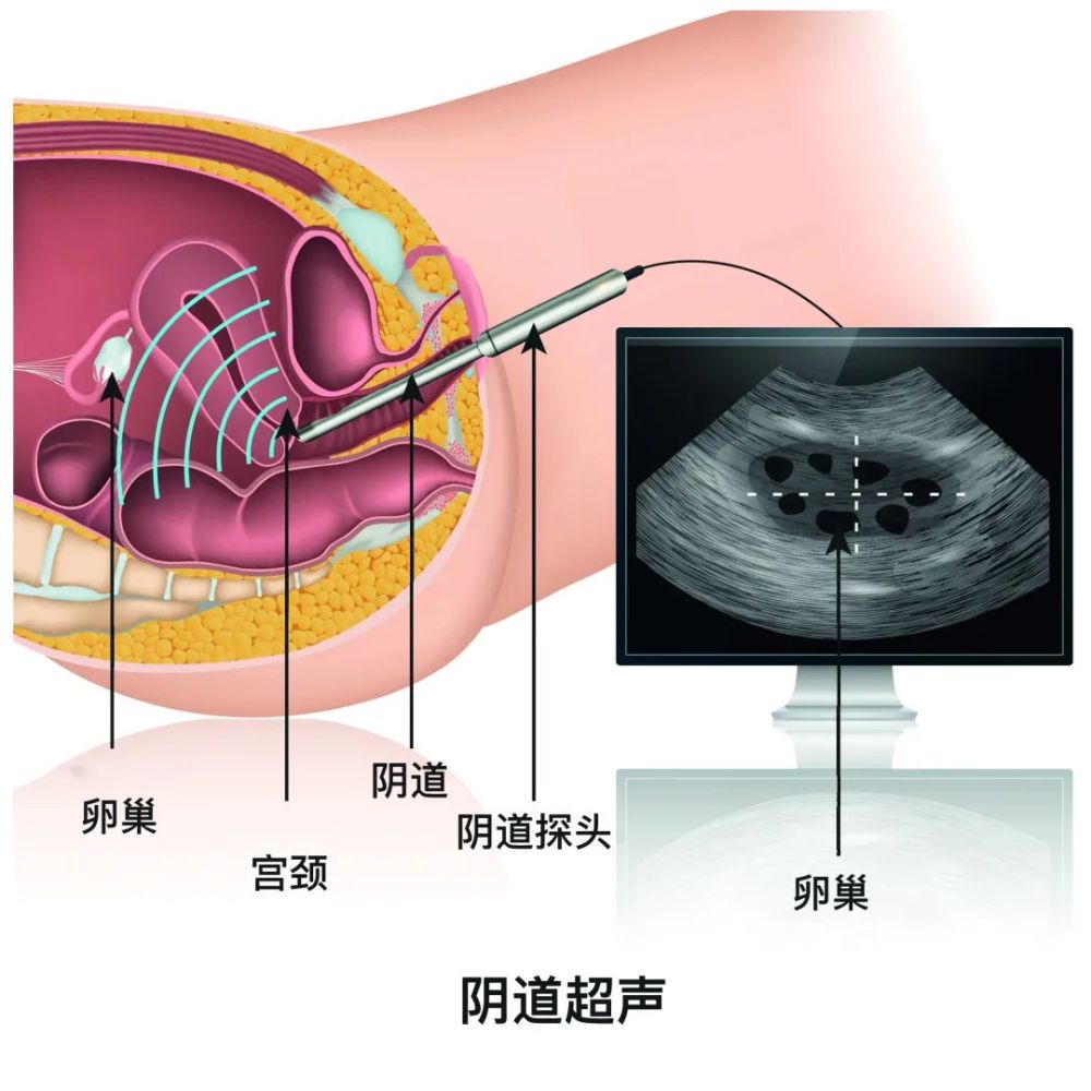 没错!这份《妇科就诊黄历》速速收藏