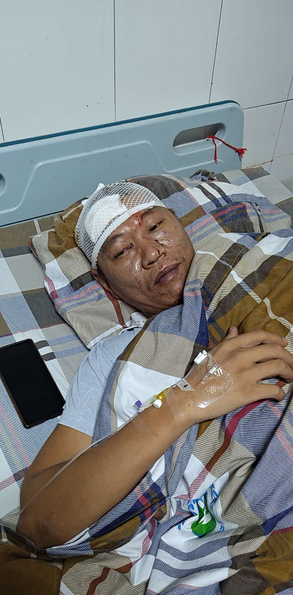 普宁一司机行车途中遭乘客殴打致头部流血