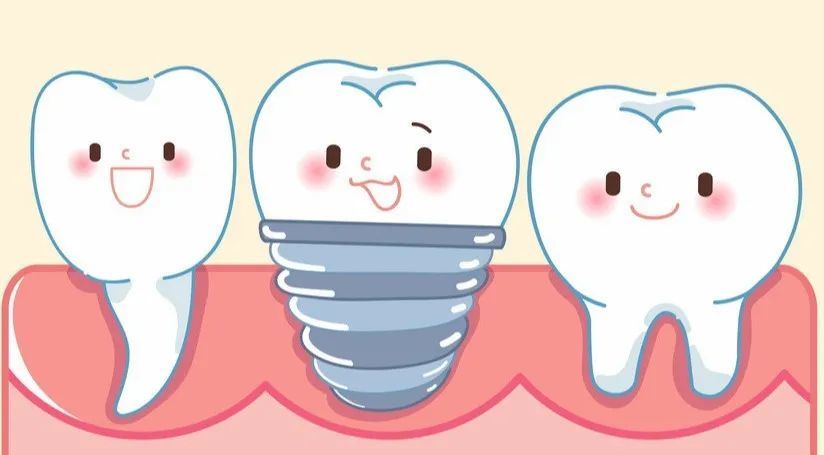 项目:单颗种植修复及半口,全口种植修复,即刻种植修复,美学修复,嵌体