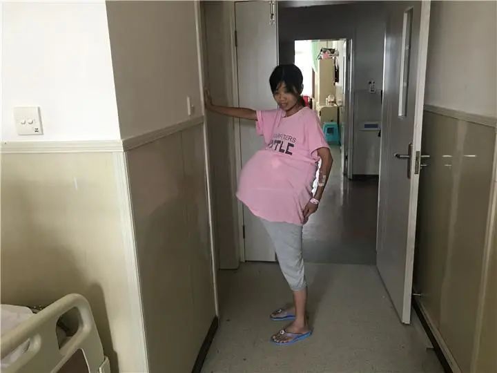 【巨肚妈妈】2年时间女子肚子疯长成巨球,每晚只能坐着睡觉…背后的