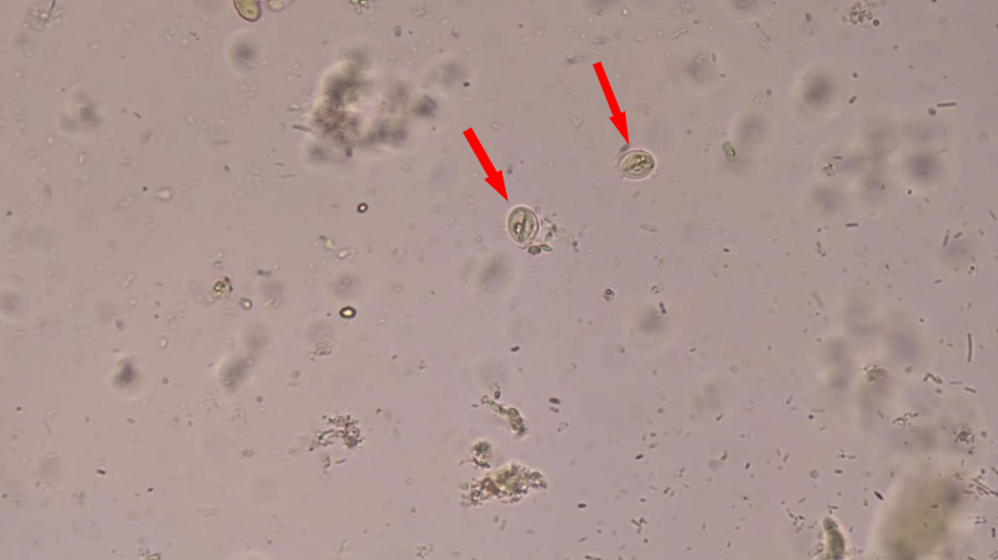 于是,我转到高倍镜镜检,发现这些可疑"虫卵"内有一