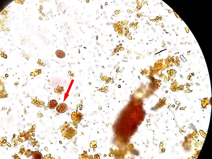 粪便中遇见鬼脸