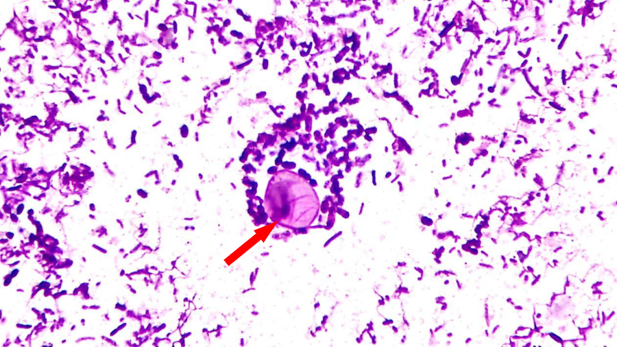 粪便中遇见鬼脸