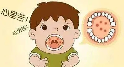你家宝宝患过疱疹性咽峡炎吗？