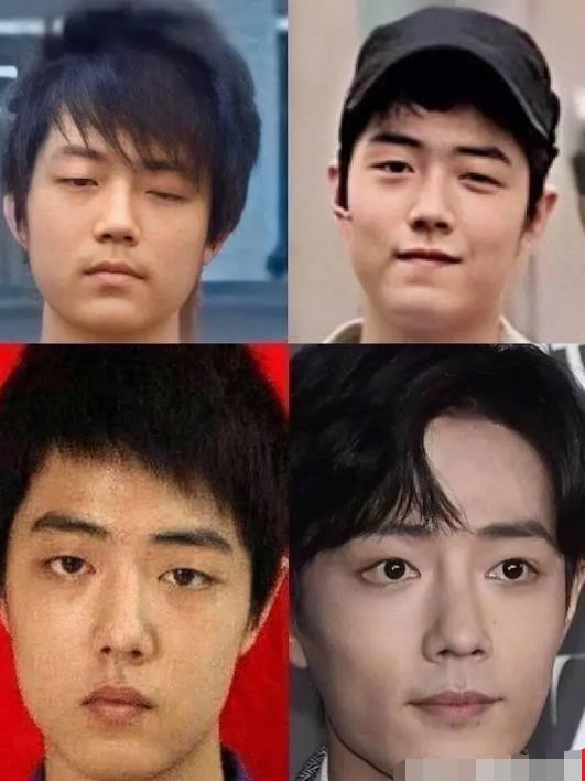 她在个人主页上晒出了疑似肖战面部变化的照片,让人大跌眼镜