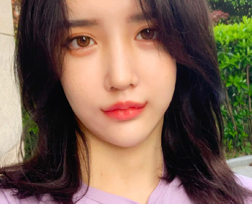 艾比为获得微笑唇整容却因手术失误闭不上嘴看着让人难受