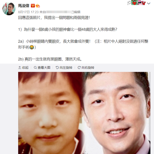 对此,马浚伟自曝,自己真的没做过任何整容手术,小时候的眼皮是内双