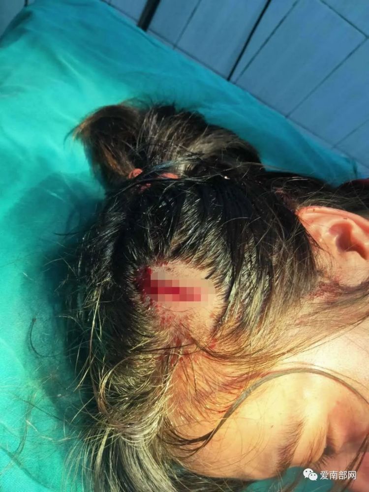 【城事】南部一女子在ktv遭男子用啤酒瓶"爆头"_腾讯新闻