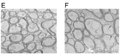 化合物|PNAS：腰果壳化合物具有修复受损神经的潜力！
