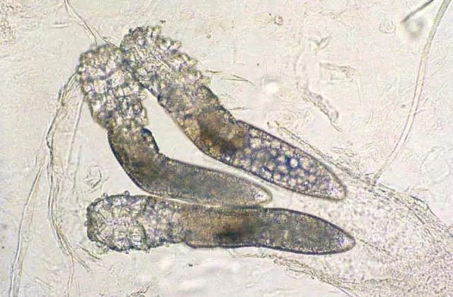 蠕形螨最喜欢待在人的睫毛和皮肤了,特别是老年人,70岁以上的老年人群